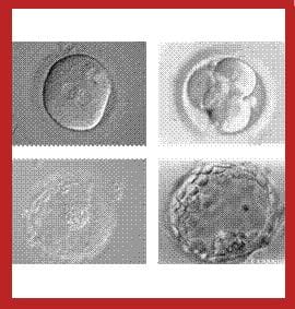 Embryoscope, ¿revolución para los embarazos?